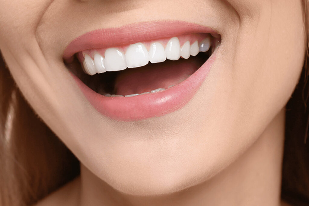 Sorriso de Hollywood na Turquia