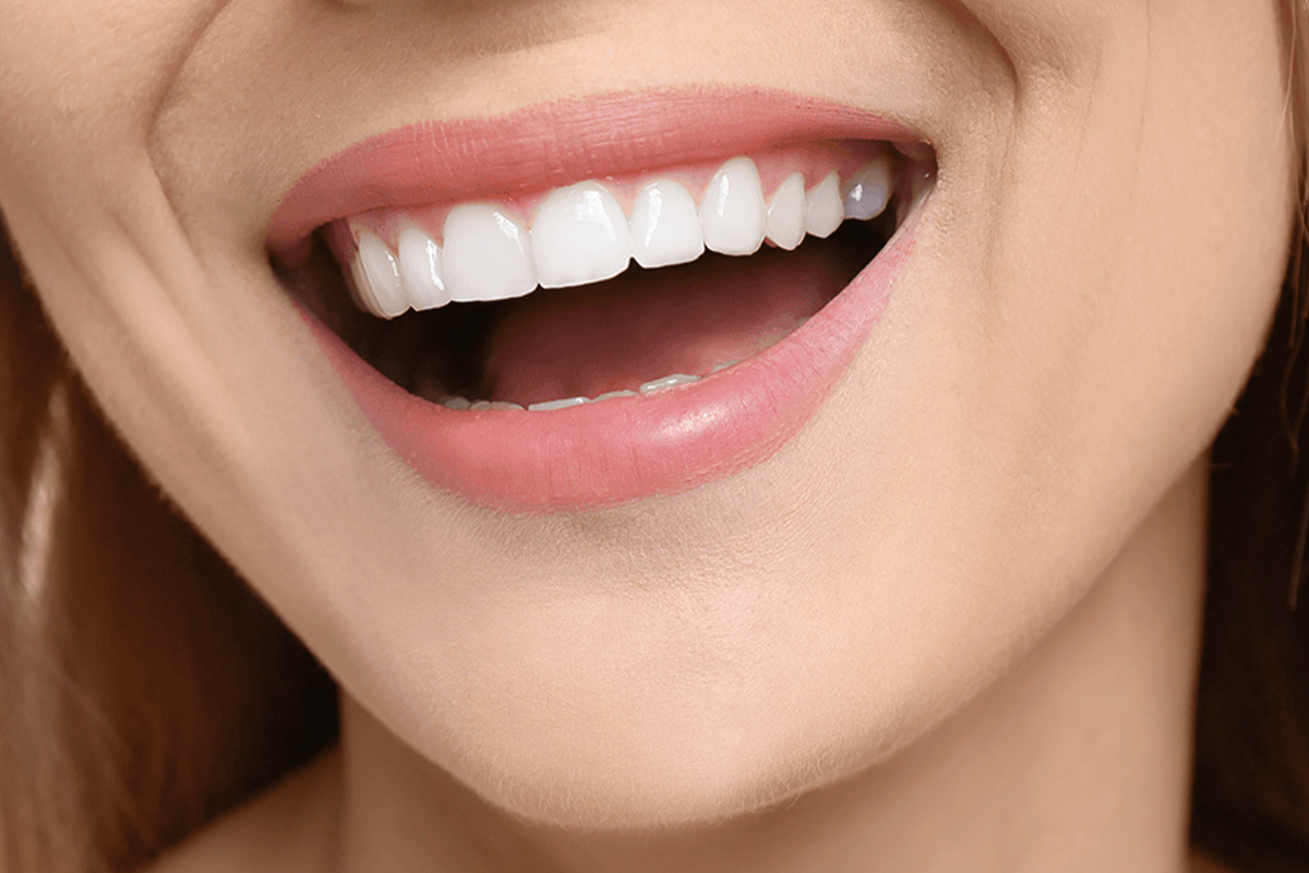 Sorriso de Hollywood na Turquia